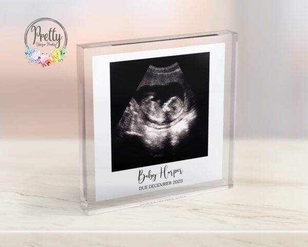 Baby Scan Photo On Acrylic Block